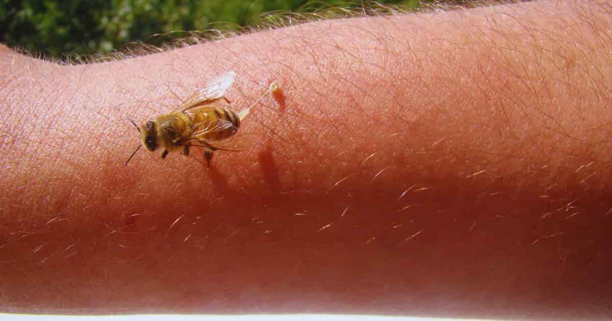 Neighbors may have worries about being stung by bees